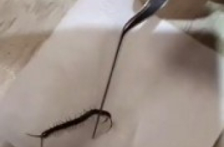 Rết dài 10cm sống trong tai người phụ nữ ở Đài Loan