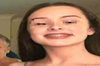 Cô gái trẻ suýt mất mạng sau khi niềng răng