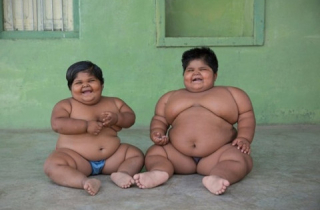 Hai chị em béo phì phải cắt bớt dạ dày để giảm cân