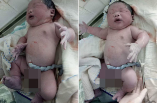 Kinh ngạc trước những em bé vừa chào đời đã có cân nặng khủng nhất Việt Nam