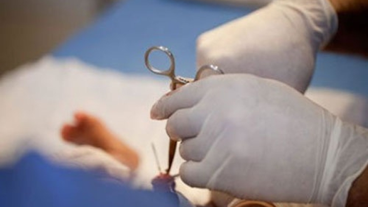 Sai lầm thường gặp khiến bao quy đầu bị cắt oan uổng