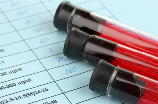 Ung thư gan cướp nhiều sinh mạng Việt nhất trong các loại ung thư