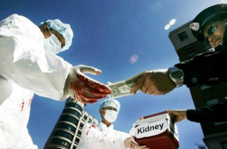 Bệnh viện Việt Đức phát hiện nhiều cặp cho - nhận thận không cùng huyết thống