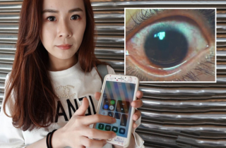 Cô gái thủng 500 lỗ ở giác mạc do dùng điện thoại màn hình quá sáng