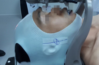 Bệnh nhân ung thư chỉ cần 6 lần xạ trị nhờ kỹ thuật mới