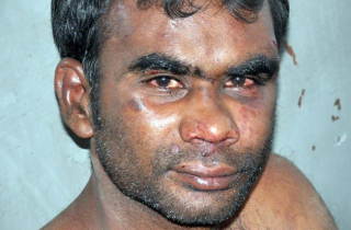 Tội ác ghê rợn của nghịch tử coi mẹ như súc vật