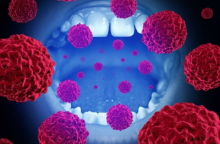 Oral sex và nguy cơ ung thư đầu cổ