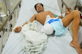 Sống sót kỳ diệu trong rừng sau 6 ngày bị rắn độc cắn