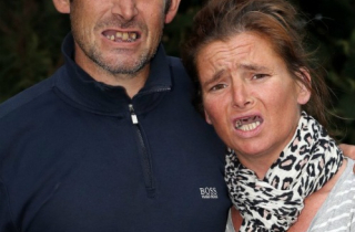 Đôi uyên ương tự nhổ hàm răng sau bốn năm không được khám chữa