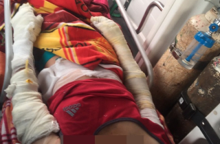 Nhà cháy rụi, cô giáo ở Phú Quốc bị bỏng rất nặng