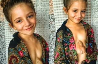 Trái tim đập ngoài lồng ngực của cô bé người Nga