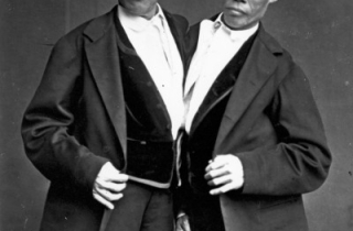 Cuộc đời gây tò mò của cặp song sinh dính liền 200 năm trước