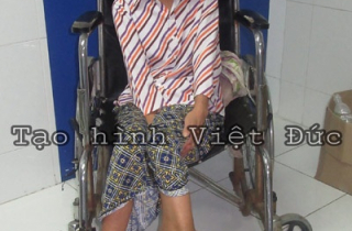 Giải cứu bệnh nhân mang khối u khổng lồ 10 kg