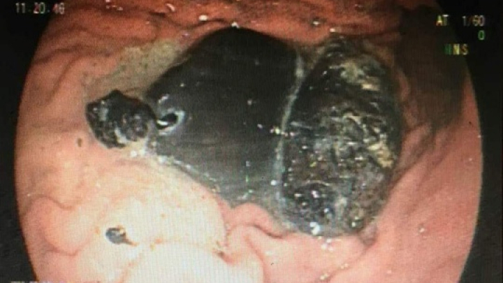 Cô gái có hai tượng Phật nằm trong bụng