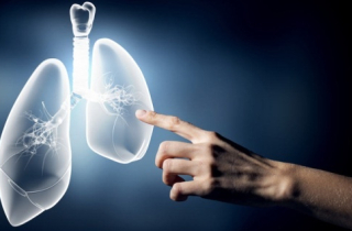 Bước tiến mới trong phẫu thuật ung thư phổi