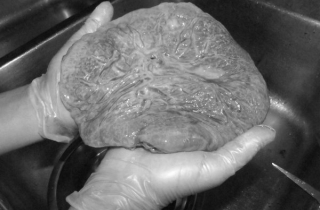 Sản phụ ăn nhau thai của mình có bổ?