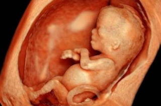 Thai hóa đá có ảnh hưởng gì đến sức khỏe người mẹ không?