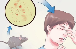 Mắc bệnh sodoku vì bị chuột cắn