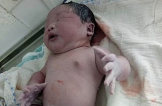 Bé sơ sinh nặng nhất Việt Nam chào đời ở Vĩnh Phúc