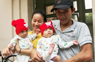 Cặp song sinh dính liền xuất viện khỏe mạnh sau mổ tách