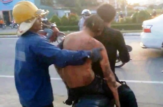 Cắt bỏ 2 tay khi kéo cây sắt trúng đường điện