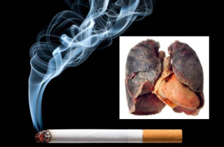 Ung thư phổi nguy hiểm thế nào