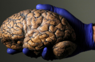 Bác sĩ phẫu thuật não từ xa cho bệnh nhân cách 3.000 km qua mạng 5G