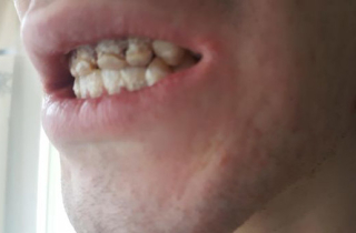 Thầy giáo trẻ mòn dần lưỡi vì thức uống 