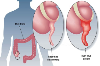 Điểm danh 7 cơ quan nội tạng dù mất đi bạn vẫn có thể sống khỏe mạnh