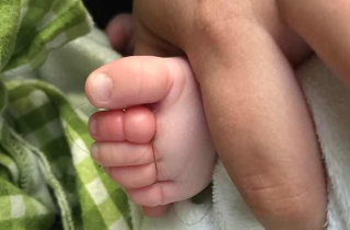 Bé sơ sinh suýt phải cắt bỏ 4 ngón chân vì 1 sợi tóc của mẹ