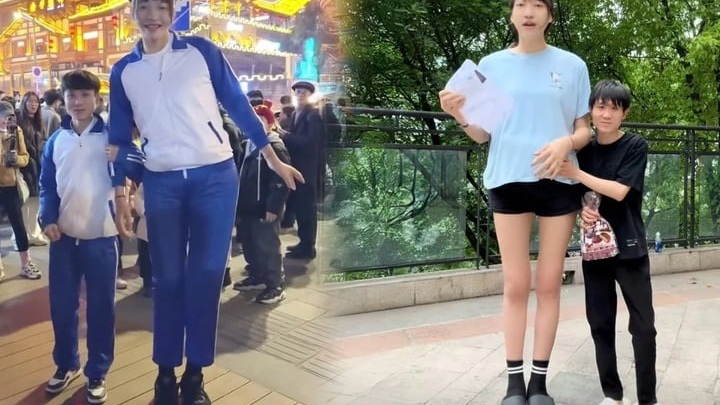 Bất chấp phản đối, cô gái 2,2m quyết sinh con cho 'chàng lùn' 1,68m