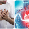 Biểu hiện truỵ tim mạch bạn không nên chủ quan