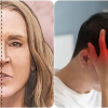 7 triệu chứng sắp bị đột quỵ cần lưu ý và xử lý ngay