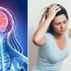 Lối sống xấu khiến đột quỵ gia tăng ở người trẻ