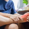 Hai dấu hiệu điển hình của bệnh Chikungunia để phân biệt với sốt xuất huyết