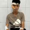 Lời khai của quái xế đi vào đường cấm phục vụ A80, tông cảnh sát cơ động
