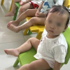 Tình trạng sức khỏe bé gái 1 tuổi bị bầm tím mặt khi gửi nhà trẻ ở Bắc Ninh