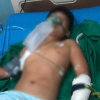 Sức khỏe bé trai sống sót trong vụ thảm án ở Đắk Lắk ra sao?
