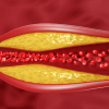 Cách kiểm soát cholesterol ở mức an toàn nhất