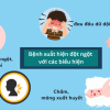 Khuyến cáo phòng chống dịch bệnh Viêm não mô cầu