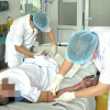 Không chạm vào điện, vẫn bị bỏng nặng do tia hồ quang