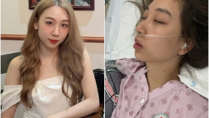 Cơn đau đầu bất thường kéo cô gái 28 tuổi vào biến cố đột quỵ