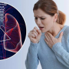 9 dấu hiệu ung thư phổi giai đoạn đầu thường bị bỏ qua