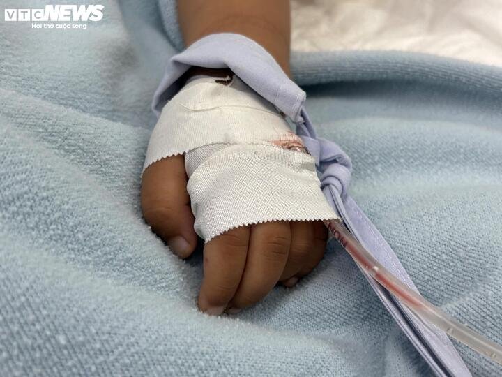 Bác sĩ cảnh báo, trẻ nhập viện trễ có thể dẫn đến các biến chứng nặng.