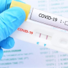 Bộ Y tế khuyến khích người dân ở TP.HCM tự test nhanh COVID-19 tại nhà