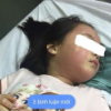 Thực hư vụ bé gái 5 tuổi nổi mẩn khắp người nhập viện cấp cứu nghi do ngộ độc trà sữa