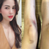 Vợ hot girl của Việt Anh gây bàn tán vì hình ảnh bạo lực gia đình