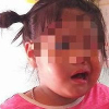 Tạm đình chỉ công tác cô giáo bị tố đánh bé 3 tuổi liệt dây thần kinh, méo mồm