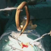 Người đàn ông lĩnh hậu quả vì nuốt lươn sống dài 30cm vào bụng