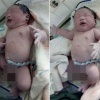 Kinh ngạc trước những em bé vừa chào đời đã có cân nặng khủng nhất Việt Nam